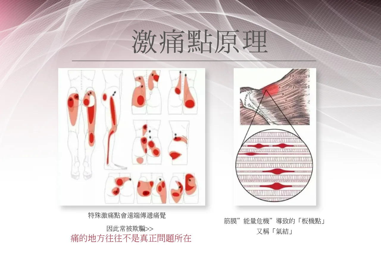 骨骼與關節長期受力示意插圖,說明姿勢與關節負擔關係的肩頸衛教圖