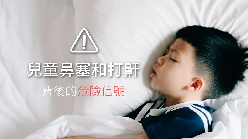 一名兒童側睡、張口呼吸的睡眠示意插圖,呈現夜間打鼾與鼻塞的情境